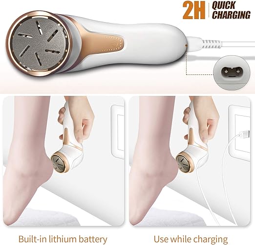 Storm Foot Grinder | Best Electric Foot File for Dead Skin Removal