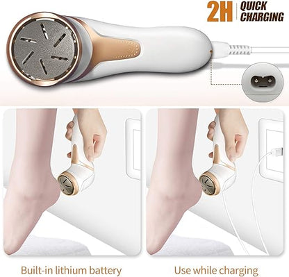 Storm Foot Grinder | Best Electric Foot File for Dead Skin Removal