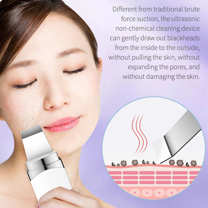 Ultrasonic Facial Skin Scrubber | Deep Pore Cleanser & Peeling Beauty Instrument